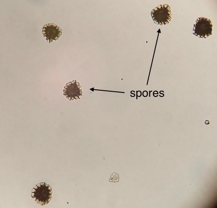 Asterella bolanderi spores