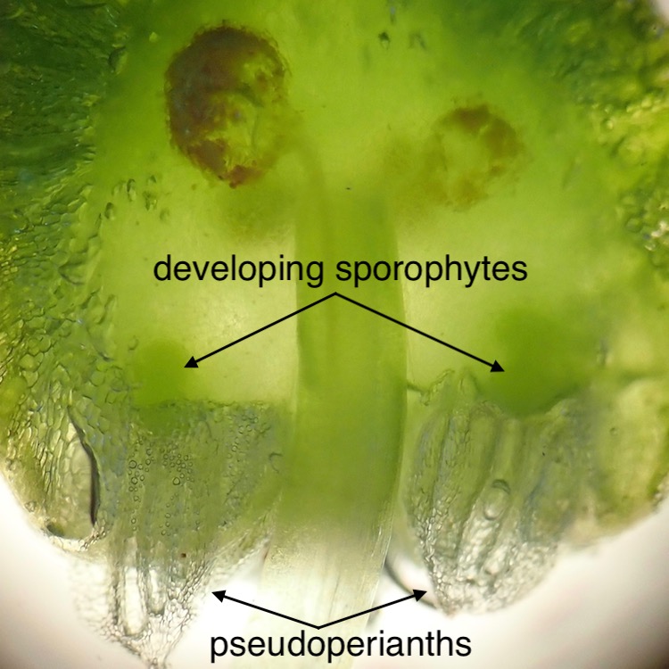 Asterella palmeri developing sporophytes