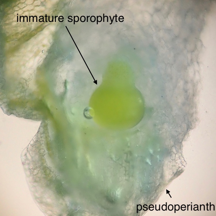 Asterella palmeri immature sporophyte