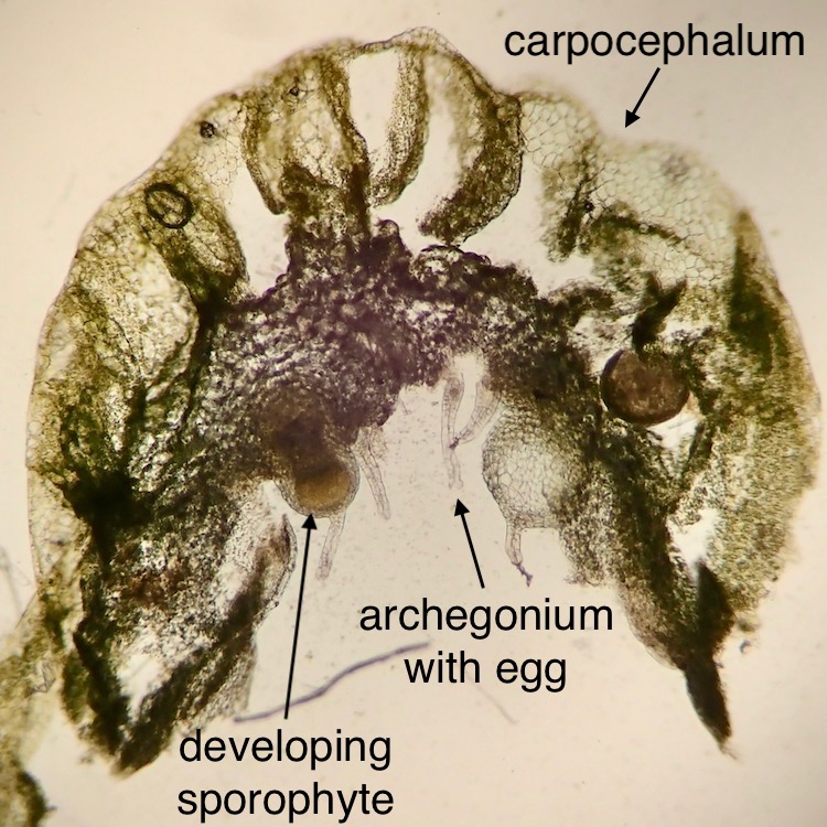 Cryptomitrium tenerum carpocephalum