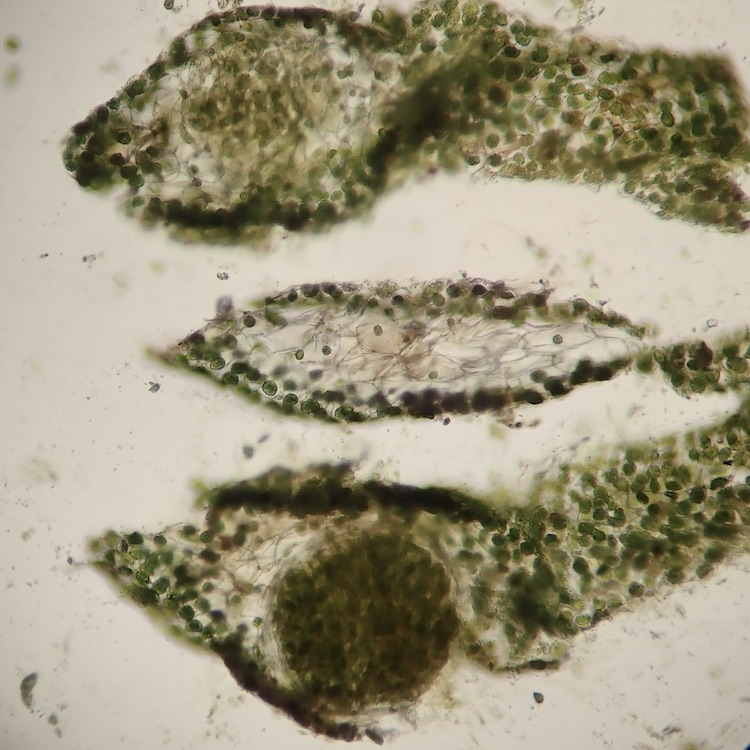 Phymatoceros phymatodes cross sections