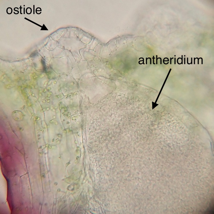 Targionia hypophylla antheridium and ostiole
