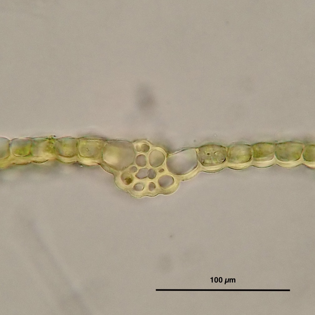 Acaulon muticum var. rufecens leaf section