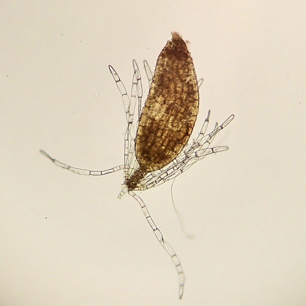 Bestia longipes antheridium
