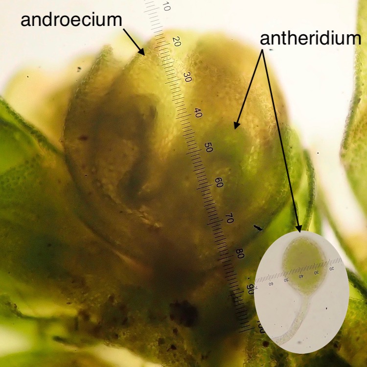 Frullania catalinae androecium