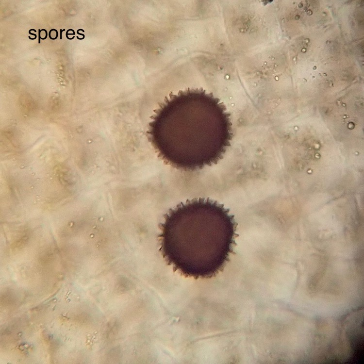 Fossombronia longiseta spores