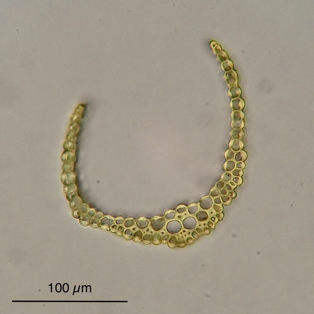 Pleuridium acuminatum leaf section