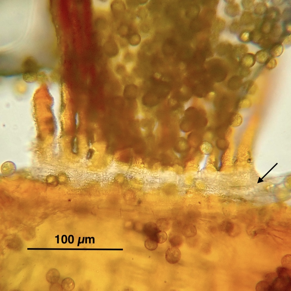 Aloina aloides var. ambigua basal membrane