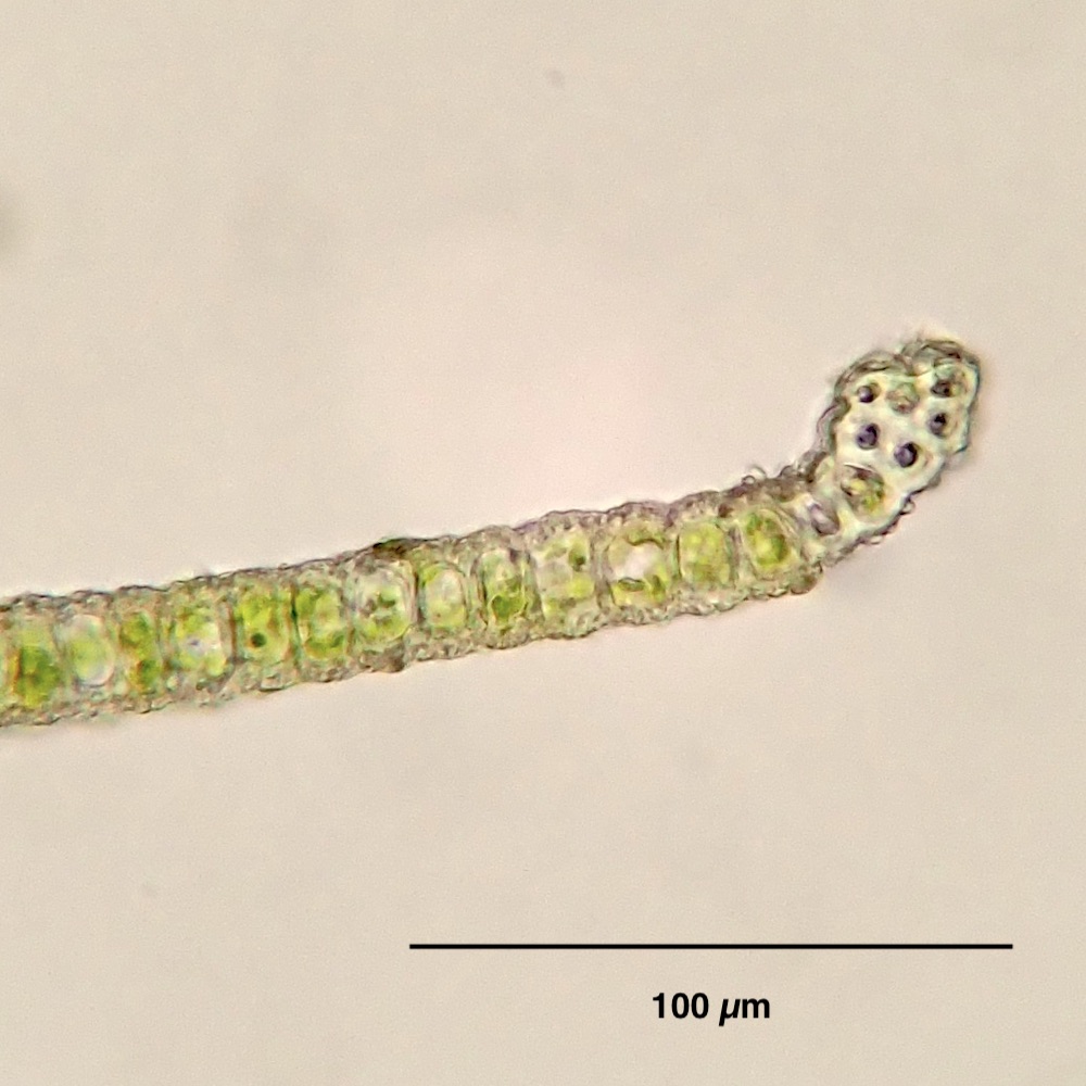 Hennediella stanfordensis leaf margin cross-section