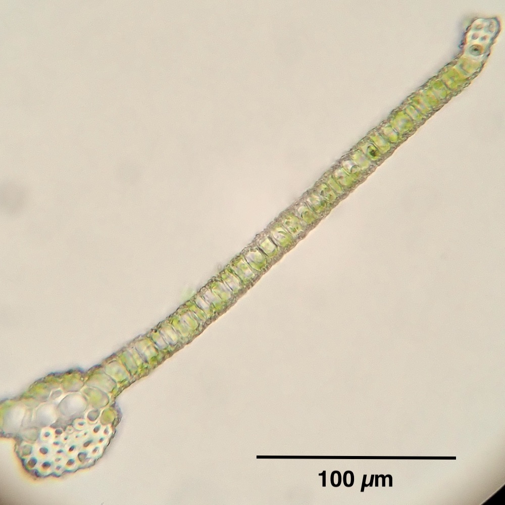 Hennediella stanfordensis leaf cross-section