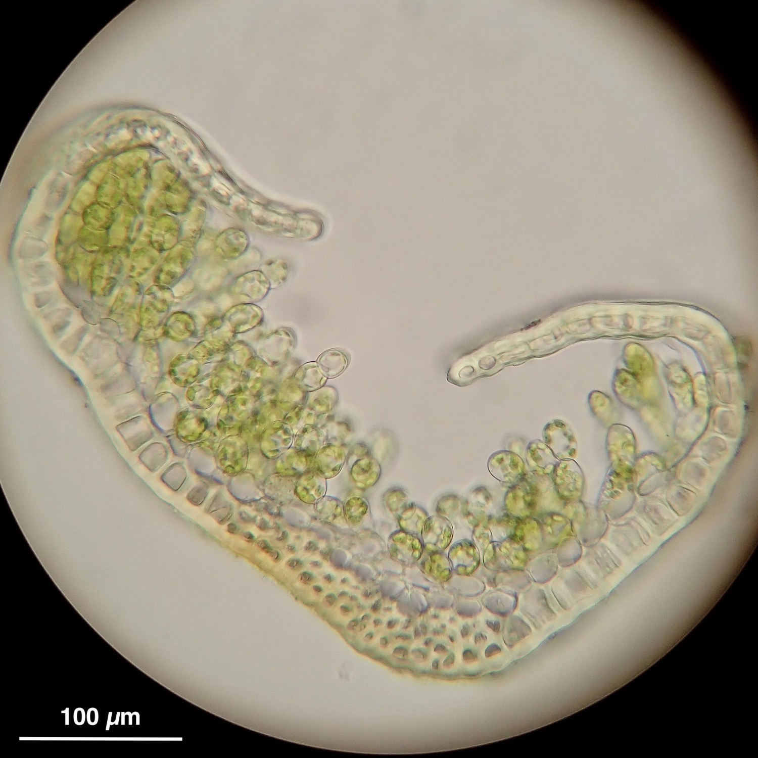 Aloina ambigua leaf cross-section