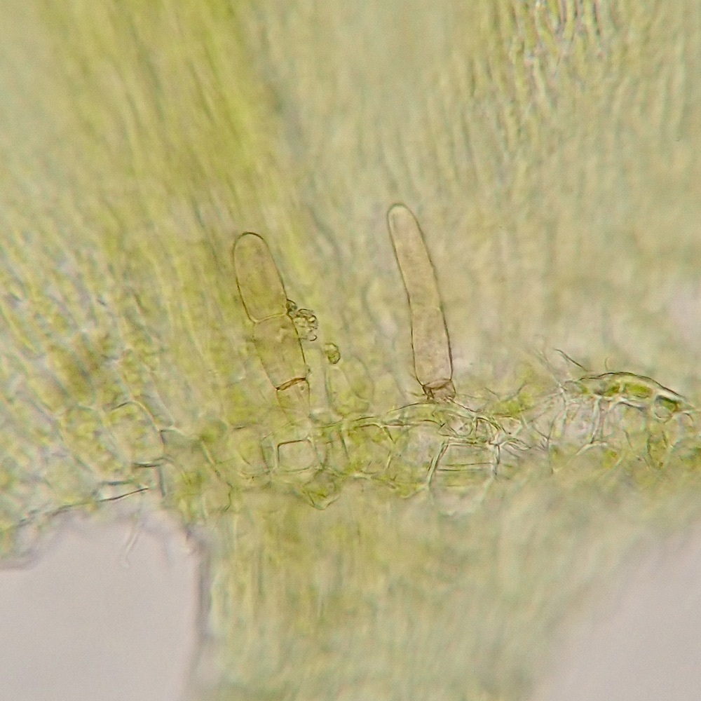 Scleropodium obtusifolium axillary hairs